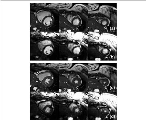 Figure 4 Left ventricular coverage. Twelve short-axis slice planes from apex to base (left to right) at end-diastole (a,b) and end-systole (c,d) for2D (a,c) and 3D (b,d) scans are shown