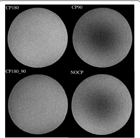 Figure 3 Percentage SNR decrease using iMSDE relative to the standard sequence without blood suppression (in gel phantoms).Comparison of SNR change is plotted against the idealized case (computing theoretical signal intensity change as a function of the in