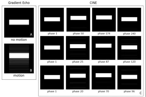 Figure 10 shows results obtained from the MRISIMULsimulator by applying a Phase Contrast (PC) velocity