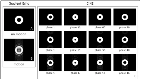 Figure 8 GE images of the heart motion model. (A) Application of the gradient echo pulse sequence on the heart model under no motion.No artifacts observed