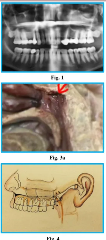 Fig. 1 Fig. 2