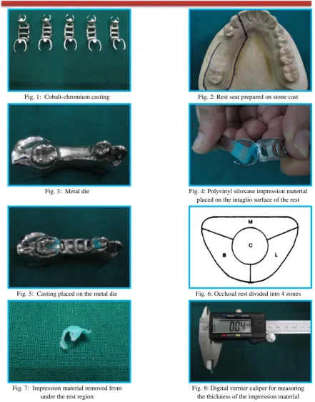 Fig. 3:  Metal die 