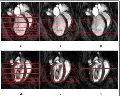 Figure 1 Location of short axis CMR slices (red lines) included in the a) full b) six slice and c) four slice guide-point modeling analyses ofan infarcted mouse, and d) full e) six slice and f) four slice guide-point modeling analyses of a control mouse, overlaid on the long axisfour chamber slice (TE/TR = 1.8/4.6 ms; field-of-view (FOV) = 25.6 × 25.6 mm, image size 256 × 256, NAE = 2, bandwidth = 147 kHz).Orthogonal two chamber slice not shown.