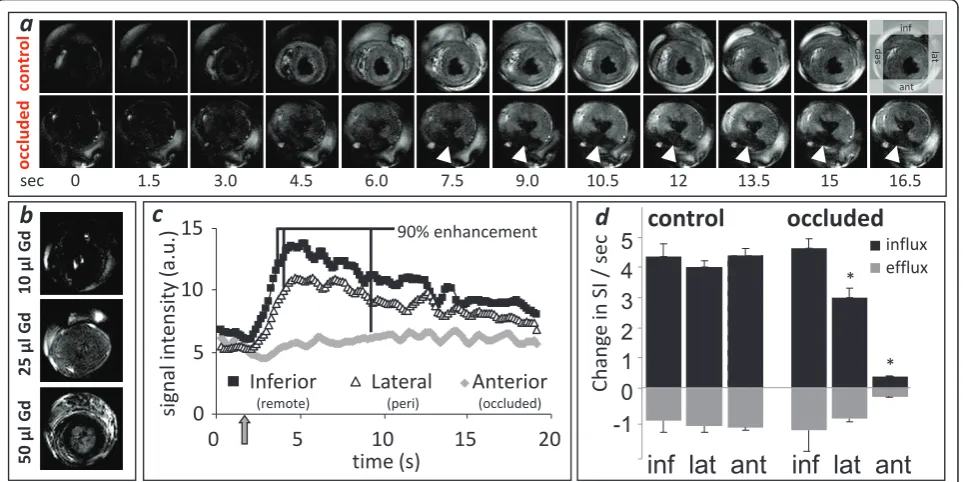 Figure 1 First-pass imaging of the isolated, perfused rat heart. (a) 12 of the 128 images acquired prior to, during and after bolus Gdinfusion from control and ex vivo occluded perfused hearts: (b) Images showing effect of different Gd bolus volumes; (c) S
