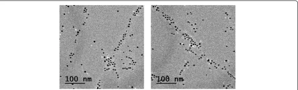 Figure 5 Alignment of palladium nanoparticles obtained with the microemulsion method (preliminary results).