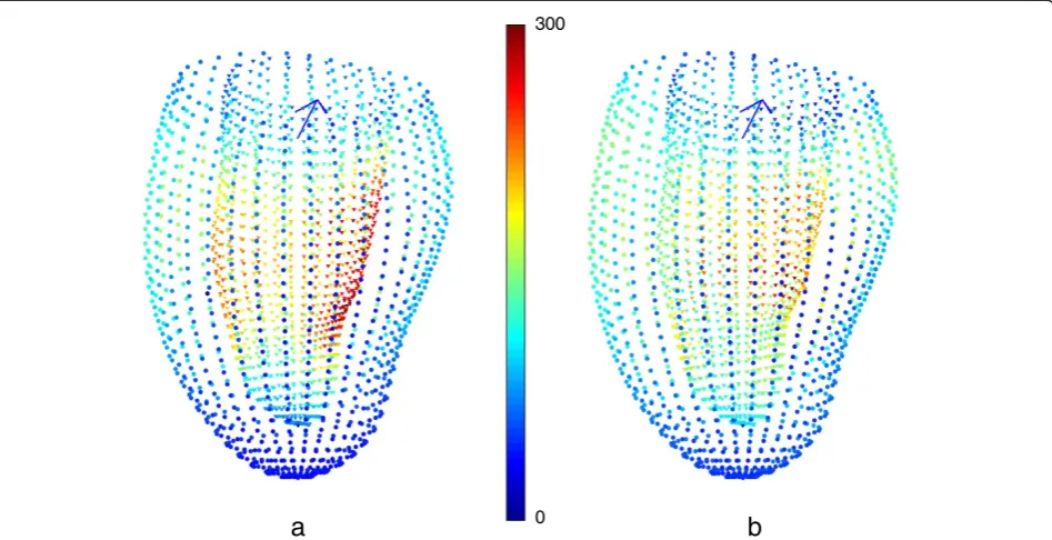 Figure 6 Application of shape correction to the analysis of myocardial infarction. a) Hotelling’s T2 for the infero-lateral DETERMINEsubcohort (N = 27) compared to the MESA cases (N = 300) without any protocol-bias correction