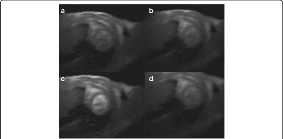 Figure 1 Series of dynamic images after contrast bolus injection (0.1 mmol/kg body weight Gd-DTPA) in a short axis section of amouse