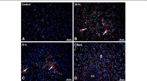 Figure 1 QDs localization and accumulation in the liver of Carassius gibelio is highlighted by fluorescence microscopy