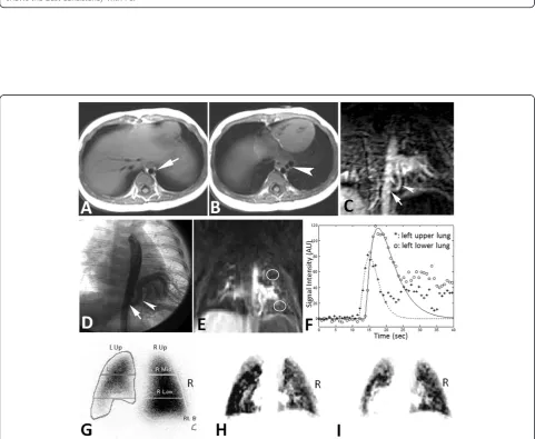 Figure 4 Bland-Altman analysis plots of the percent flow to 6 ROIs compared with PS, (A) rPBV (B) rPBF (C) rPBViw analysis
