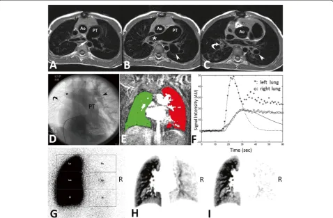 Figure 6 (A-C) A serial of ECG-gated spin echo T1-weighted image.left lung (red) and right lung (green)