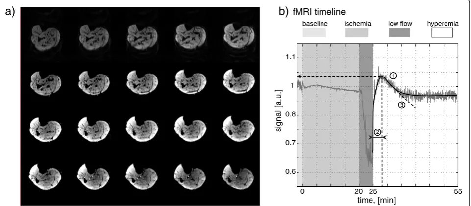Figure 1 Experimental setup. a) EPI images for every 4th minute during the experiment; b) fMRI timeline, a sample data set and description ofparameters derived from fitted curves