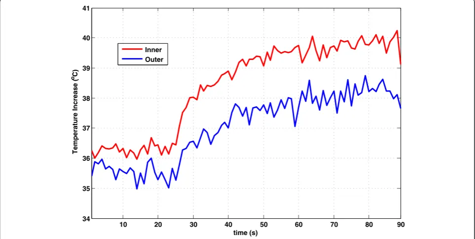 Figure 7 In vivo heating measurement. Inner (red) and outer (blue) temperature measurements of the “hot spot” at the worst-case (14 cm)insertion length, at which the guidewire remained inside the introducer sheath, using a 90° flip angle, SAR, 3.96 W/kg.