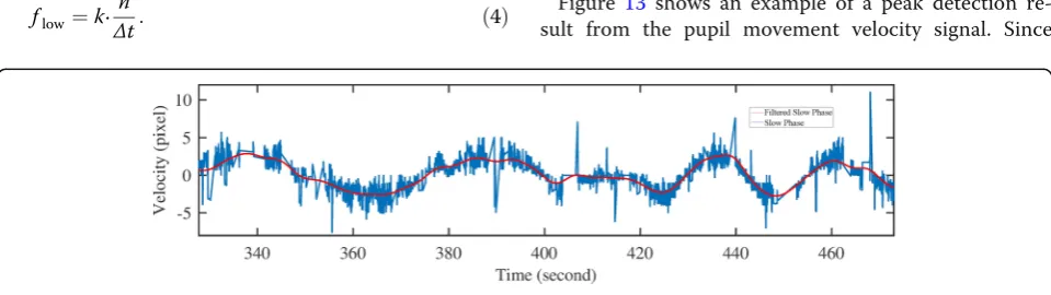 Figure 13 shows an example of a peak detection re-sult from the pupil movement velocity signal