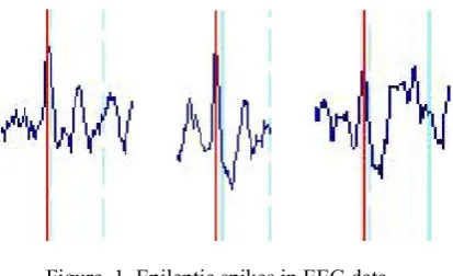 Figure  1. Epileptic spikes in EEG data,  