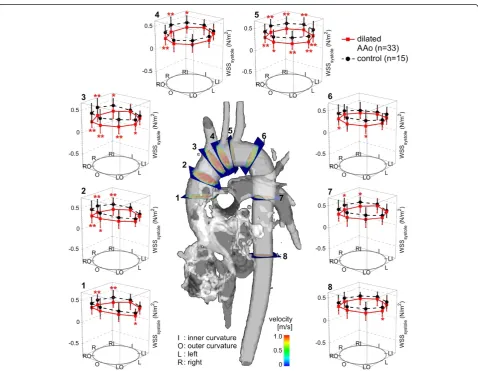 Figure 3 Distribution of regional peak systolic wall shear stress (WSS) in the ascending aorta (AAo) in aneurysm patients (n=33)compared to age-matched controls (n=15)
