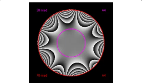 Figure 1 Zemlin tableau for measurement of aberration coefficients.