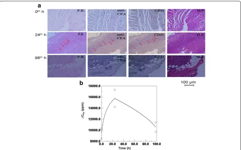 Figure 5 Biological results of the tumors of mouse 3, mouse 4, and mouse 5. (a) Tissue staining methods of HE staining, PB staining,anti-CEA staining, and CD 31 staining