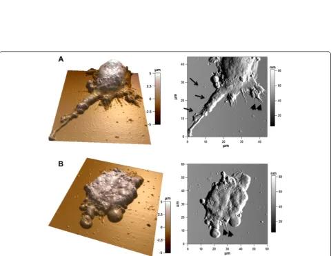 Figure 5 AFM images in contact mode of a DPSC cultured on pSi. 3D reconstruction of the AFM height image of the side of a cell, with thecorresponding deflection image and height cross section along the indicated red line.