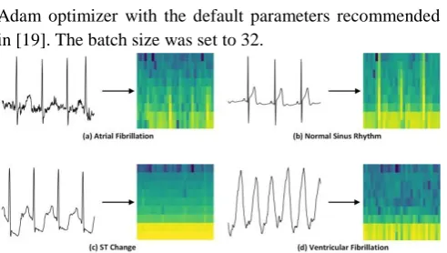Fig 5. Convolutional neural network of our proposed network 
