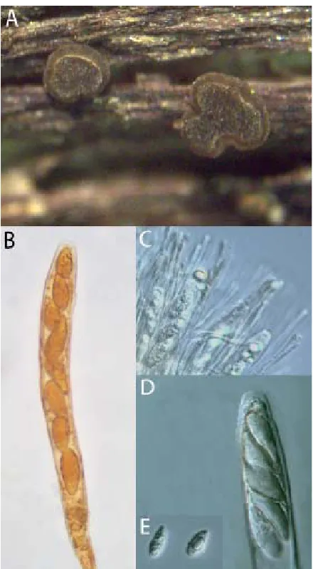 Figure 2:  Graddonia coracina ANM 2018, A: Apothecia , B: Ascus stained with Melzer’s Reagent, C: Hymenium, D: Rehydrated ascus, E: Discharged ascospores