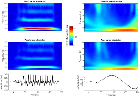 Figure 1. Inter-trial phase locking across subjects. Histogram of degree of inter-trial phase locking averaged across 20 Hz bins centered on the fundamental frequency and the first three harmonics (100, 200, 300, and 400 Hz)