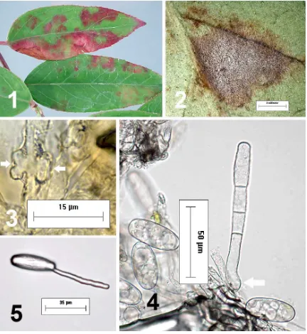 Fig. 1. Symptoms of powdery mildew of Leucothoë axillaris. Fig. 2. Lesion on abaxial leaf surfacewith mycelial growth of Oidium ericinum