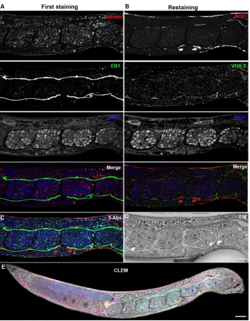 Fig. 2. Light microscopy and multipleximaging: immunolabeled C. eleganssections on coverslips