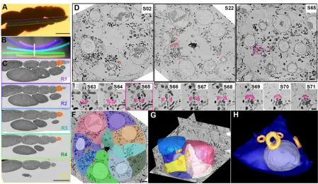 Fig. 3. Blind screening approach for morphological analysis and 3D reconstruction of AT data