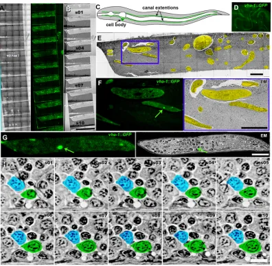 Fig. 5. MAPS-mediated screening strategy: (A) An array of sections on a wafer visualized by the light microscopy reflection mode(H) A sequence of inverted SEM images of the excretory canal cell from the subsequent sections