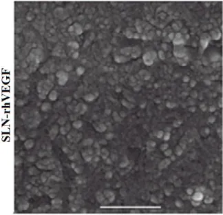 Figure – 1: Morphology of SLN rh-VEGF Nanoparticles   