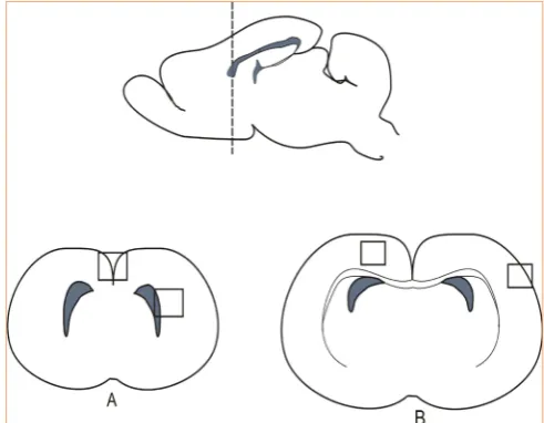 Figure 1:  Graphical representation of a rat brain showing the sagittal and coronal view of the section planes