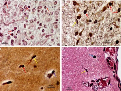 Figure 3: Silver gold staining of brain tissue showing morphological variation of microglia/macrophage in both developing and adult rat brain (×100, Oil immersion)