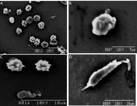Figure 5: Scanning electron micrograph of isolated microglia cells from brain tissue. (A) Microglia recovered from early embryonic developing brain show many of them retain spines bearing surfaces which radiate out of the cell body ; (B) a few cells remain amoeboid in shape with a ruffled surface membrane and short stubby projections in late embryo; (C) in neonates, the presence of both amoeboid cells with spines bearing surfaces and also extended structure of amoeboid microglia cell; (D) ramified or “resting” microglia isolated from adult brain with extended pseudopodia are seen