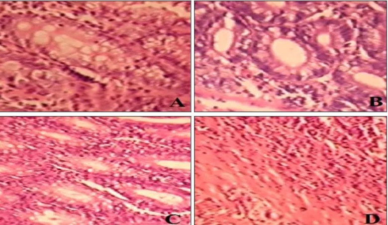 FIG. 4: HISTOPATHOLOGICAL FEATURES OF COLON SECTION. A: TEST CONTROL (RAT WITH TNBS + PE TREATMENT), B: STANDARD (RAT WITH TNBS+MESALAMINE TREATMENT), C: HEALTHY CONTROL, D: COLITIS CONTROL (RAT WITH TNBS TREATMENT) 
