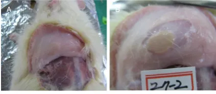 Figure 1. Macroscopic findings at injection sites. PDLLA filler injection sites can be visually confirmed