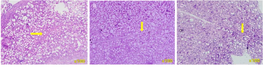 Figure 4. H&E staining (infiltration into surrounding tissues was not apparent. Inflammatory cells were visible around PDLLA microspheres