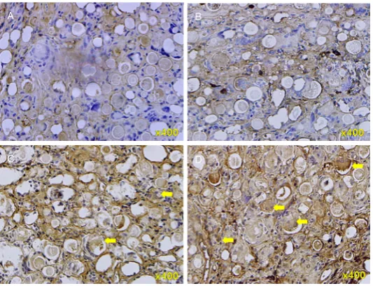 Figure 7. Immunohistochemical staining of actin (injections. A: at the 2nd week; B: at the 8th week; C: at the 12th week; D: at the 20th week