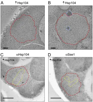 Figure 8. Hsp104 overexpression disrupts NM-YFP face between the unstructured zone and the cytosolic aggregate organization