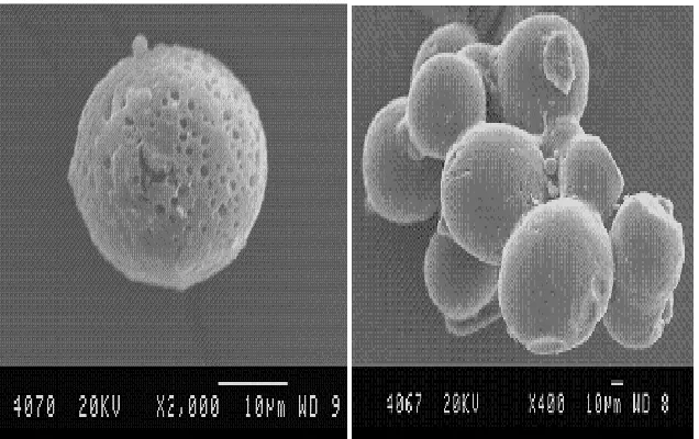 Figure no. 8: SEM photograph of formulation F1, F3 of Eudragit L 100 microspheres  