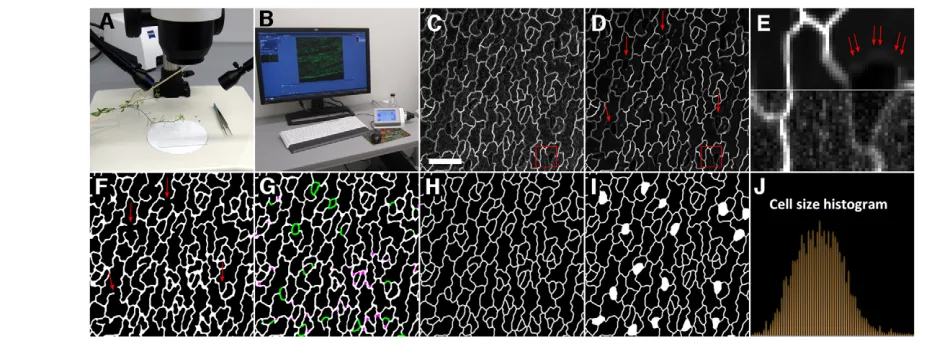 Fig. 1. Workflow example in image analysis. Successful image analysis can be achieved when all steps from sample preparation to imageoriginal projection image (C), which is somewhat noisy, is filtered using the block matching 3D (BM3D) method to produce a 