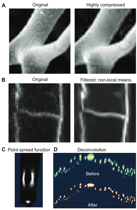 Fig. 3. Preprocessing. (of the branch point of an A)Original scanning electron micrograph (left)Arabidopsis trichome compared with the