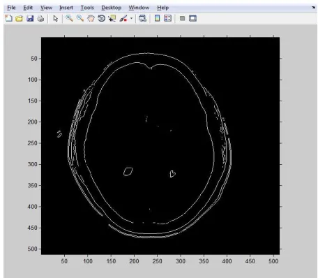 Fig. 3: Image Thresholding using Previous Method 