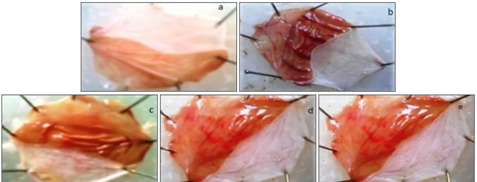 FIG. 1: OBSERVATIONS OF ULCER IN STOMACHS OF ETHANOL AND DRUG TREATMENT IN RATS. a: normal (untreated) group; b: absolute ethanol (1 mL/200 g) treated group; c: omeprazole (20 mg/kg) treated group; d: Hyperin (25 mg/kg) treated group; e: Hyperin (50 mg/kg)