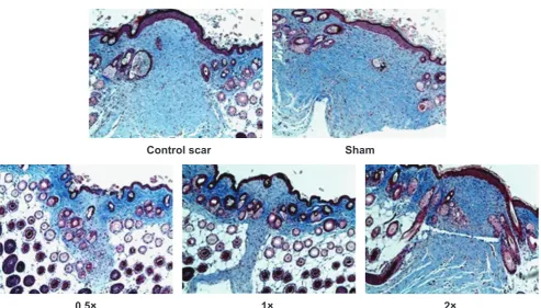 Figure 6: Levels of transforming growth factor beta 1 (TGF-β1) protein in cutaneous scar at day 20 for non-stretched and stretched tissue samples