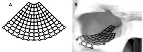 Figure 2: (A) Titanium to be used in orbital reconstruction, especially for large defect; (B) titanium mesh placed in the orbit
