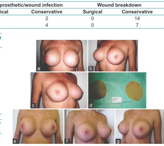 Table 4: Reasons for revisions in augmentation 