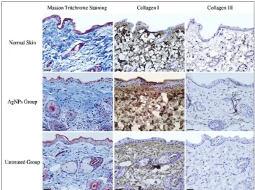 Figure 1: Histological staining of healed skin in each experimental group. Masson trichome staining shows the distribution and density of collagen protein in healed skin in various groups