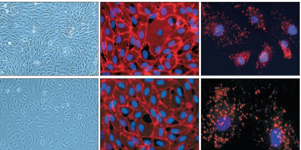 FIG. 3: ENDOTHELIAL CELLS. REPRESENTATIVE PHOTOGRAPHS OF CONFLUENT HUMAN UMBILICAL VEIN ENDOTHELIAL CELLS (HUVEC; a-c) AND HUMAN DERMAL MICROVASCULAR ENDOTHELIAL CELLS (HuDMEC; d-f) AS SEEN WITH PHASE-CONTRAST MICROSCOPY (a, d), OR STAINED WITH CD31 (b, 