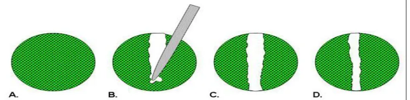 FIG. 4: (A) CONFLUENT MONOLAYER OF CELLS. (B) A WOUND IS INTRODUCED INTO A CONFLUENT  MONOLAYER OF CELLS BY DRAWING A TIP/CELL SCRAPER ACROSS THE CELL LAYER