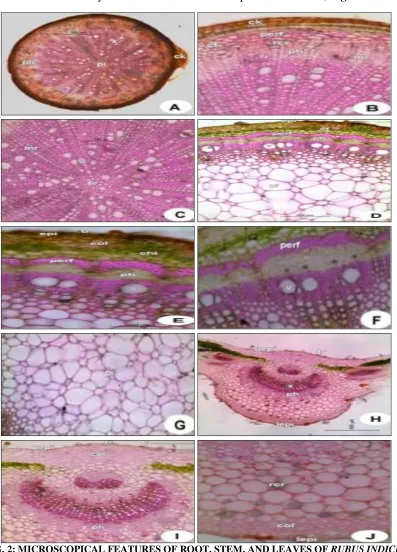 FIG. 2: MICROSCOPICAL FEATURES OF ROOT, STEM, AND LEAVES OF RUBUS INDICUSPlate 1. Microscopy of cork; col, collenchyma; ct, cortex; epi, epidermis; lepi, lower epidermis; mr, medullary rays; perf, pericyclic fibres; ph, phloem; pi, pith; rcr, rosette cryst